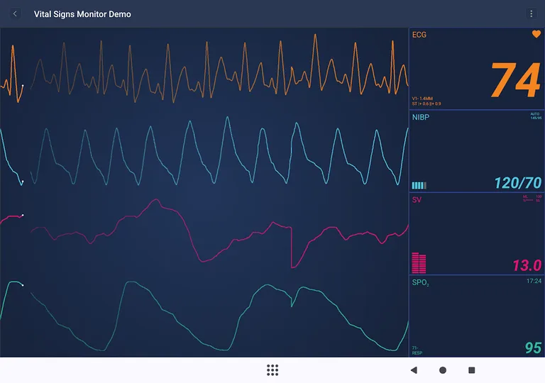 SciChart Demo screenshot 3