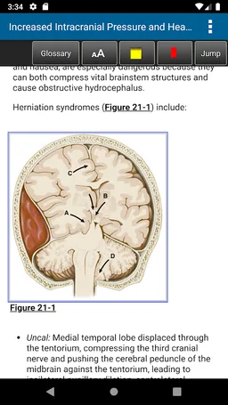 Harrison's Manual of Medicine 20th Edition screenshot 11