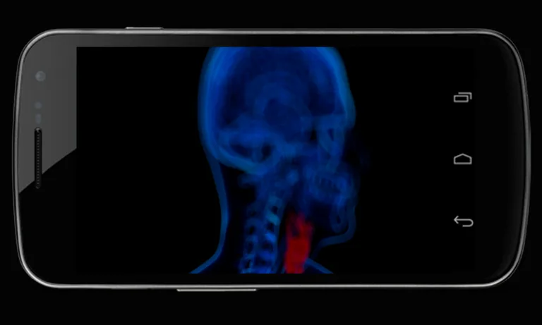 Body Xray- Prank screenshot 1