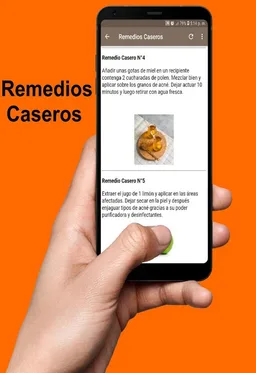 Remedios Naturales para Eliminar el Acné Gratis screenshot 5