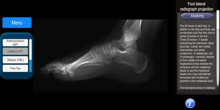 Anatomy and Radiographic Projections screenshot 1