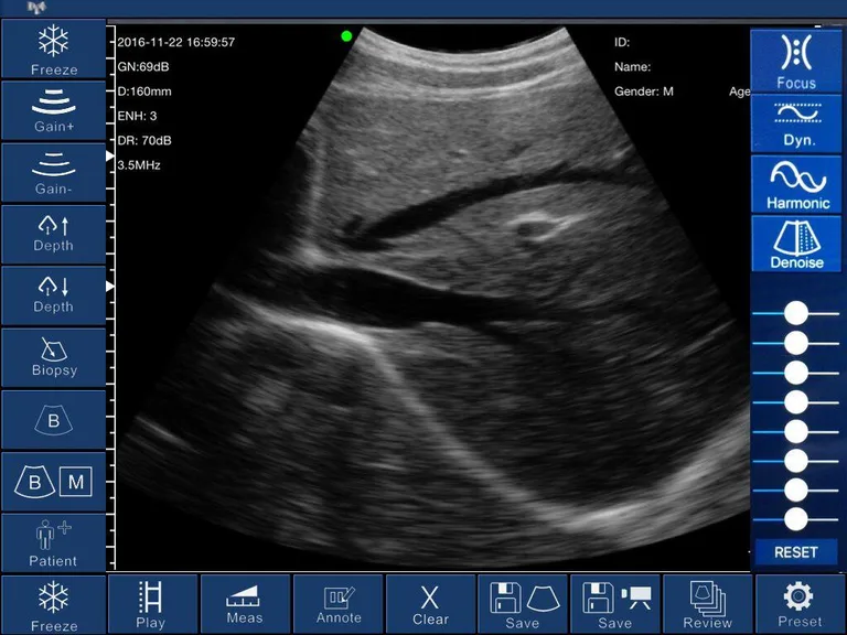 WirelessUSG screenshot 2