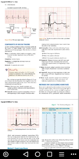 ECG / EKG Rhythm Step-by-Step Interpretation screenshot 4