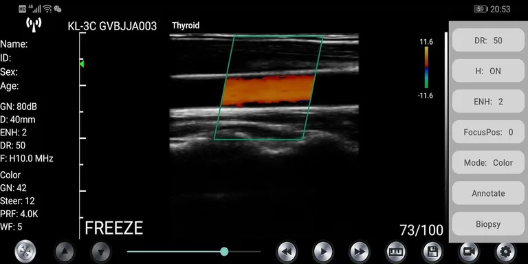 WirelessKUS screenshot 1