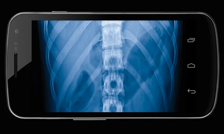 Body Xray- Prank screenshot 4