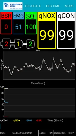 Conox View screenshot 1