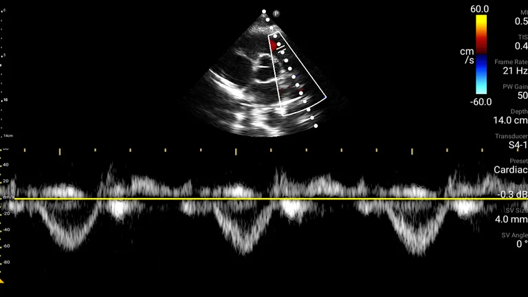 Philips Lumify Ultrasound App screenshot 6