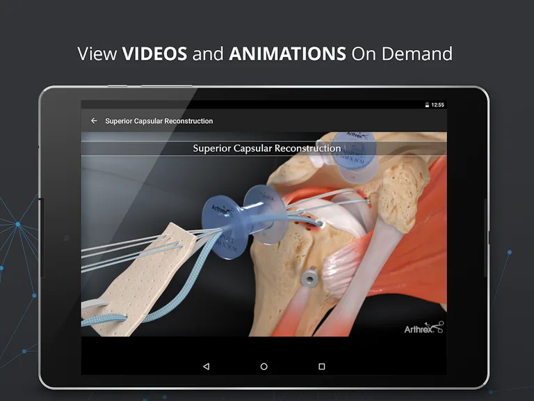 Arthrex Surgeon App screenshot 6