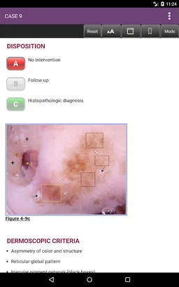 Dermoscopy: An Illustrated Self-Assessment, 2/E screenshot 18