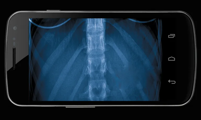 Body Xray- Prank screenshot 5