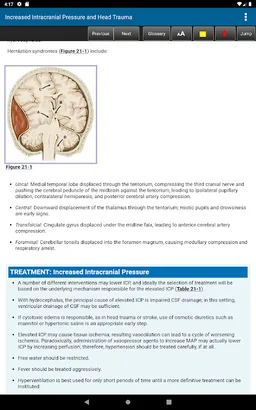 Harrison's Manual of Medicine 20th Edition screenshot 4