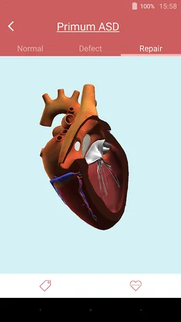 eMurmur Heartpedia screenshot 3