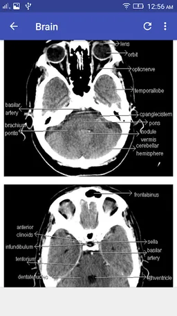 CT Scan Cross Sectional Anatomy screenshot 1