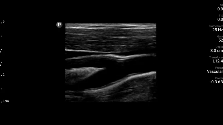 Philips Lumify Ultrasound App screenshot 4