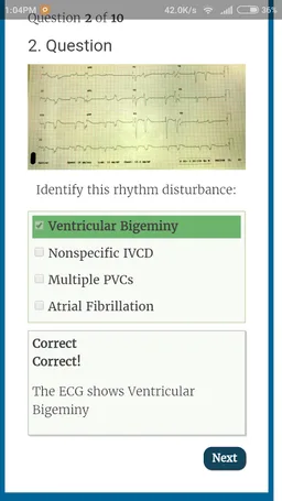 Diagnose ECG screenshot 4