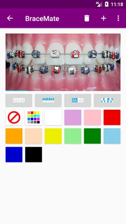 BraceMate screenshot 6