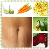 Elimina Estrías Naturalmente icon