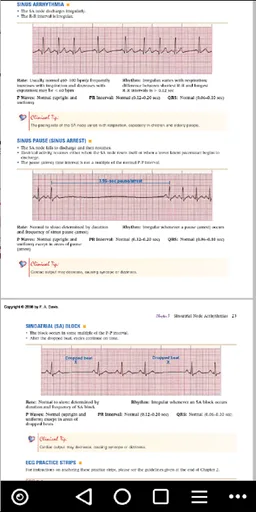 ECG / EKG Rhythm Step-by-Step Interpretation screenshot 2