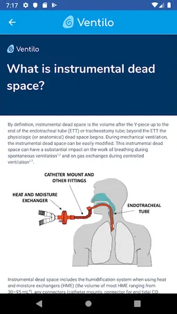 VentilO screenshot 2