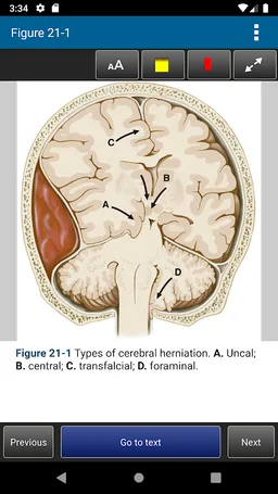 Harrison's Manual of Medicine 20th Edition screenshot 19
