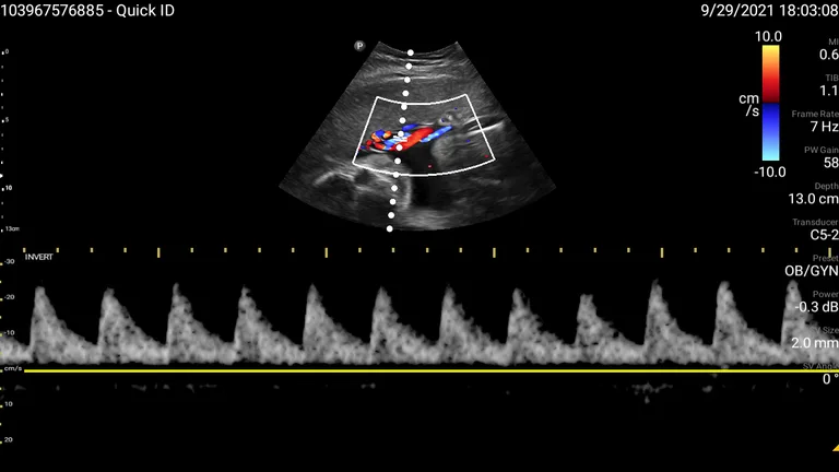 Philips Lumify Ultrasound App screenshot 3