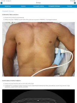 SonoSim screenshot 5