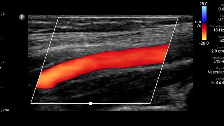 Philips Lumify Ultrasound App screenshot 2