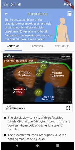 Regional Anesthesia Reference screenshot 2