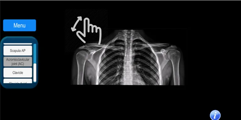 Anatomy and Radiographic Projections screenshot 7