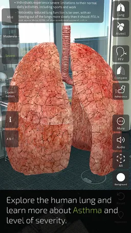 INSIGHT LUNG screenshot 6