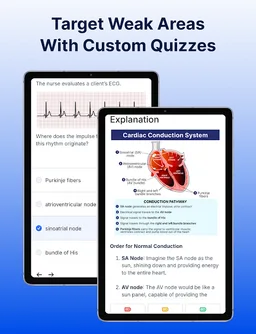NCLEX PN Mastery - Exam 2026 screenshot 13