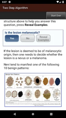 Dermoscopy Two Step Algorithm screenshot 20