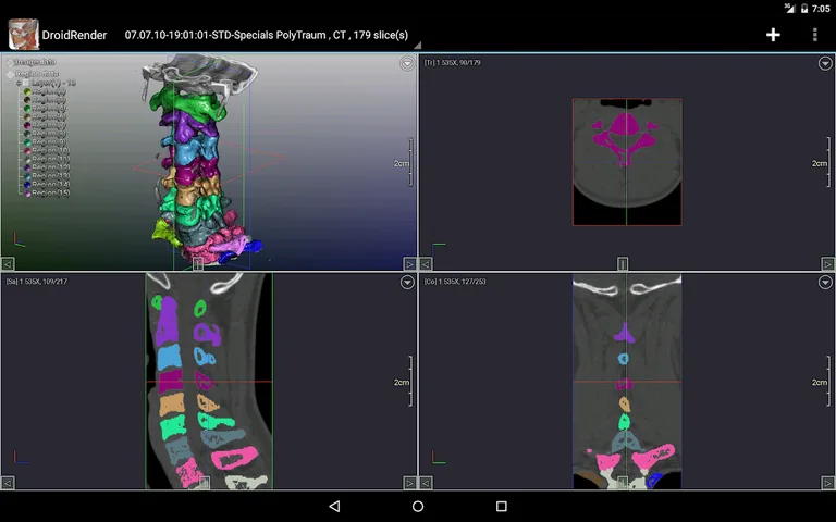DroidRender - 3D DICOM viewer screenshot 9