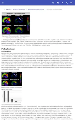Syndromes screenshot 10