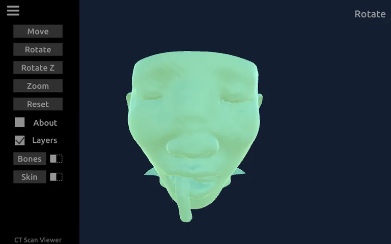 CT Scan Viewer 3D screenshot 2