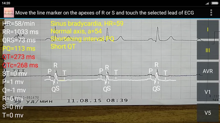ECG Reader2 free screenshot 2