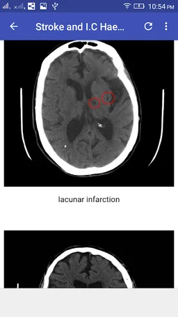 CT Brain Interpretation screenshot 5