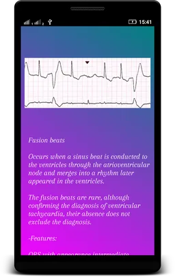 ECG Interpretation screenshot 5