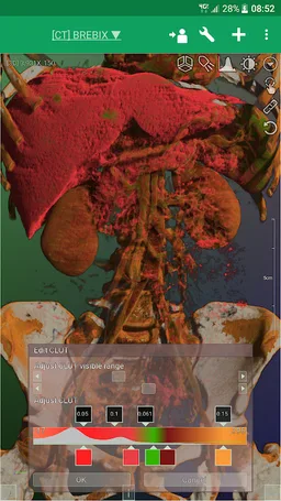 DroidRender - 3D DICOM viewer screenshot 7
