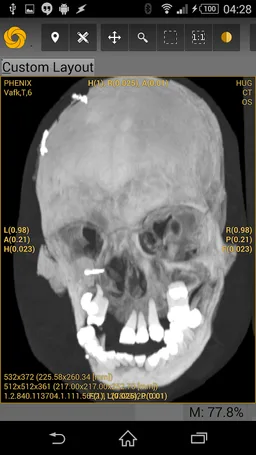 Symmetry DICOM screenshot 6